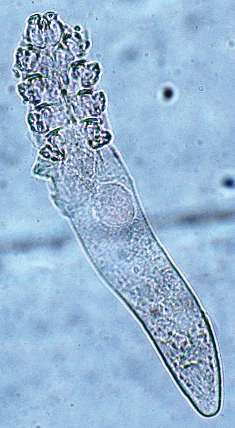 1. Dojrzała postać Demodex folliculorum (pow. 40x)