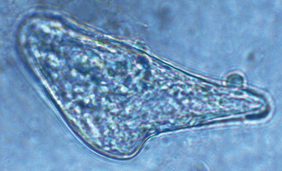 3. Jajo Demodex folliculorum (pow. 40x)