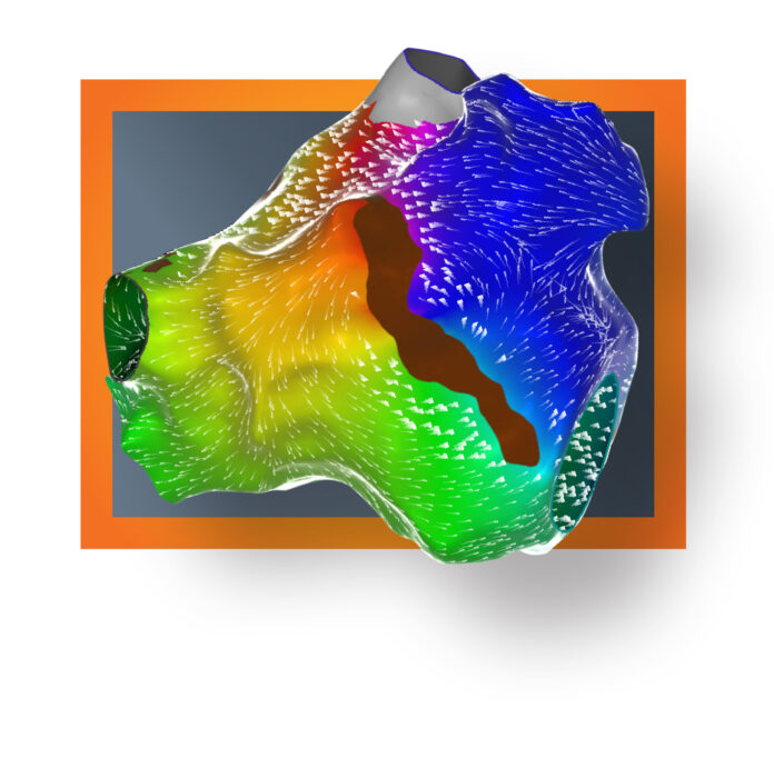 na zdjęciu znajduje się mapa serca w 3D